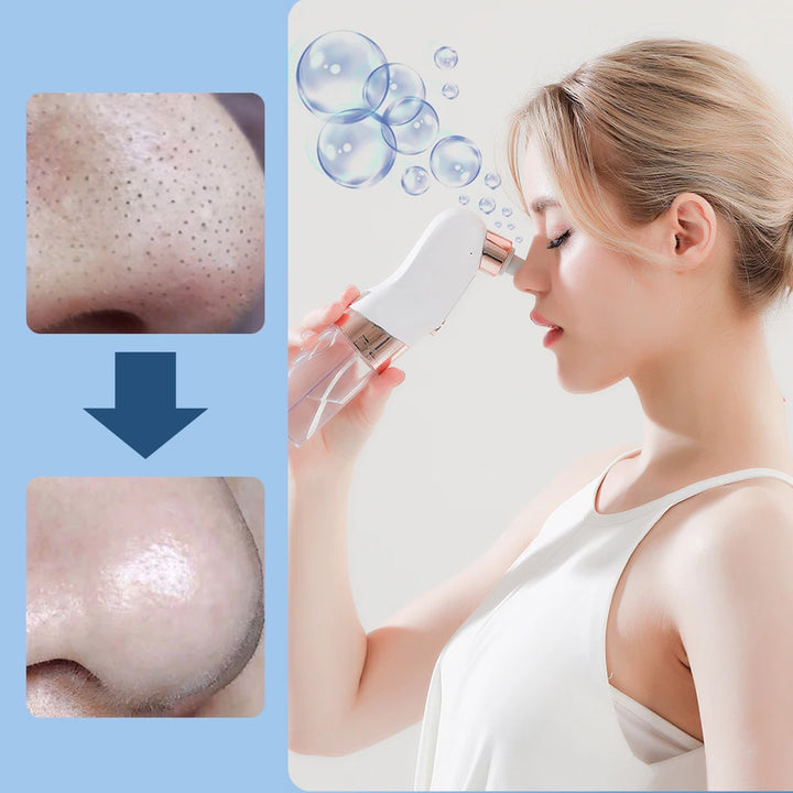 Electric Pore Vacuum and Face Cleaner