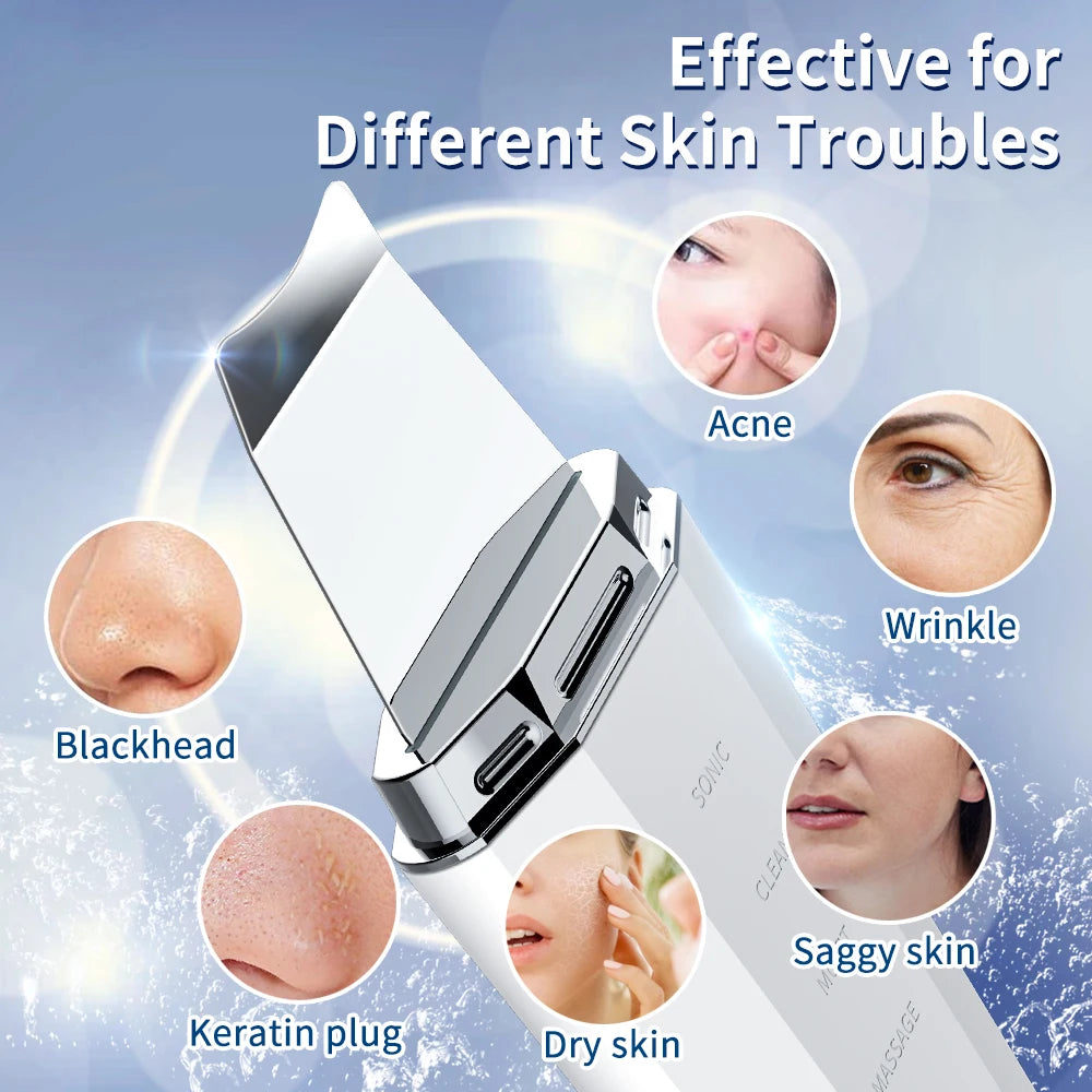 Ultrasonic Skin Scrubber with Ion Deep Cleansing and EMS Facial Lifting