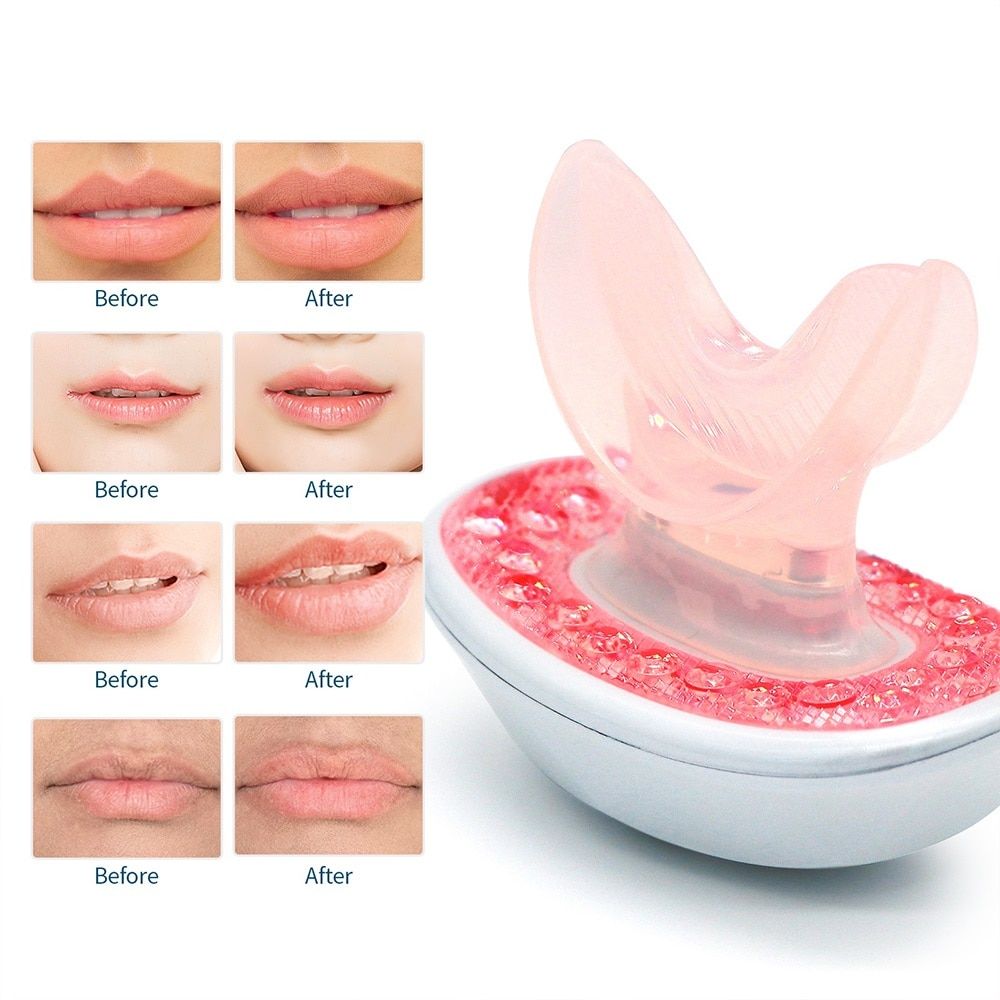 Rechargeable LED Lip Plumper Device: Restore & Enhance Natural Beauty