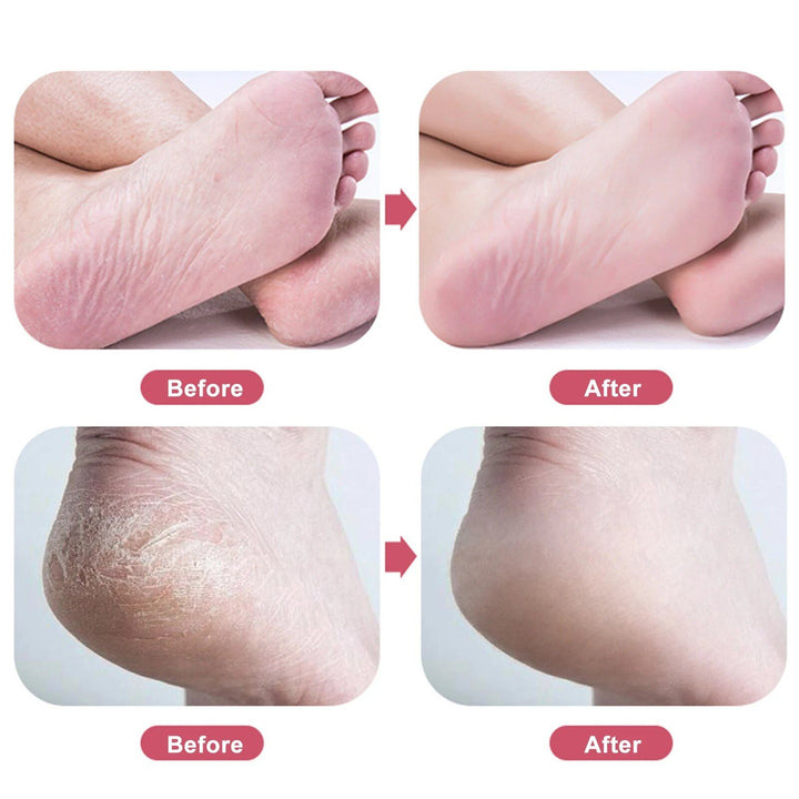 Nano Glass Foot Rasp: Quick & Gentle Callus Remover