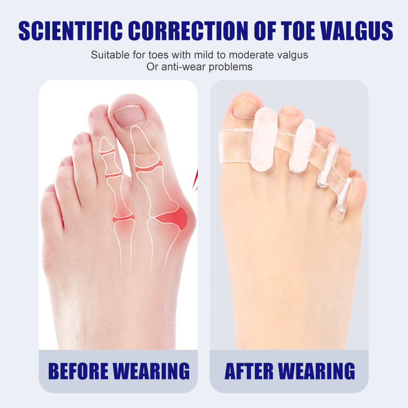 Toe Separators for Bunion Pain Relief and Hammertoe Correction