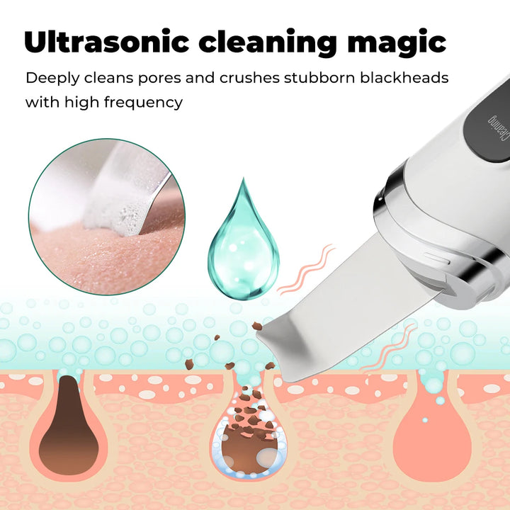 Ultrasonic Skin Scrubber for Deep Cleansing and Exfoliation