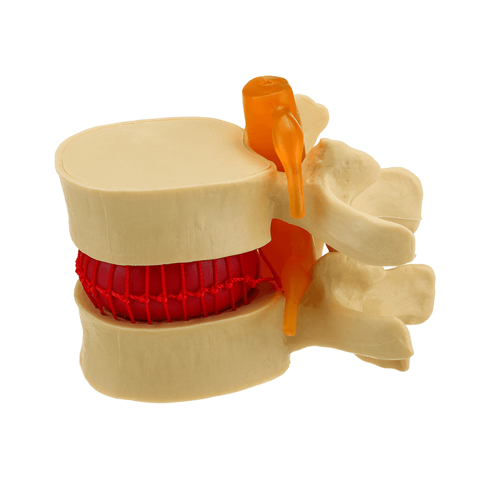 Medical Lumbar Vertebrae Model Props Anatomical Spine Herniation Teaching Tool - MRSLM